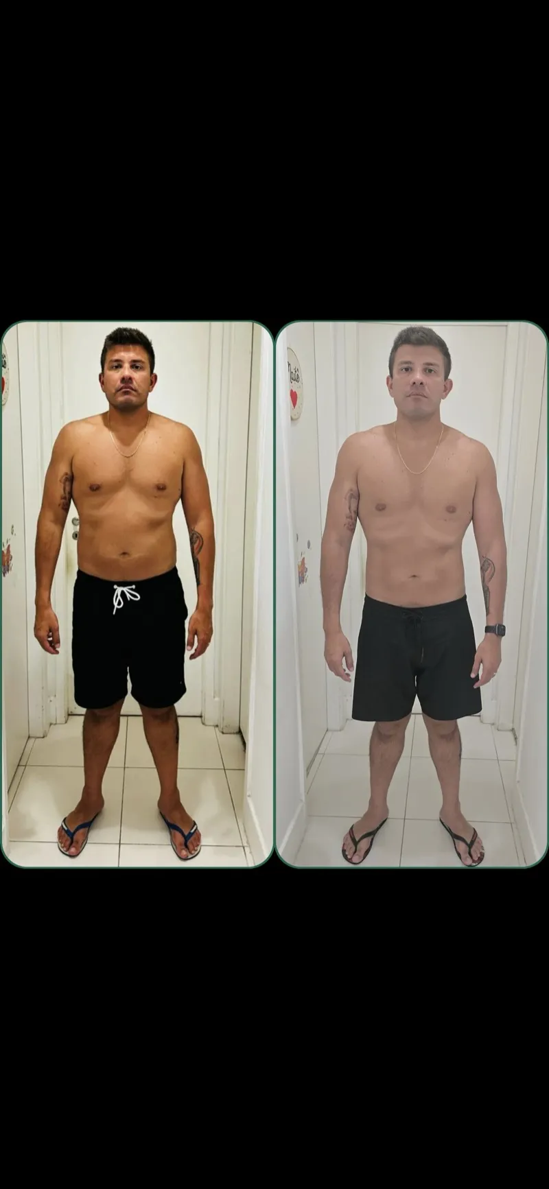 Antes e depois de paciente do Pedro Dias